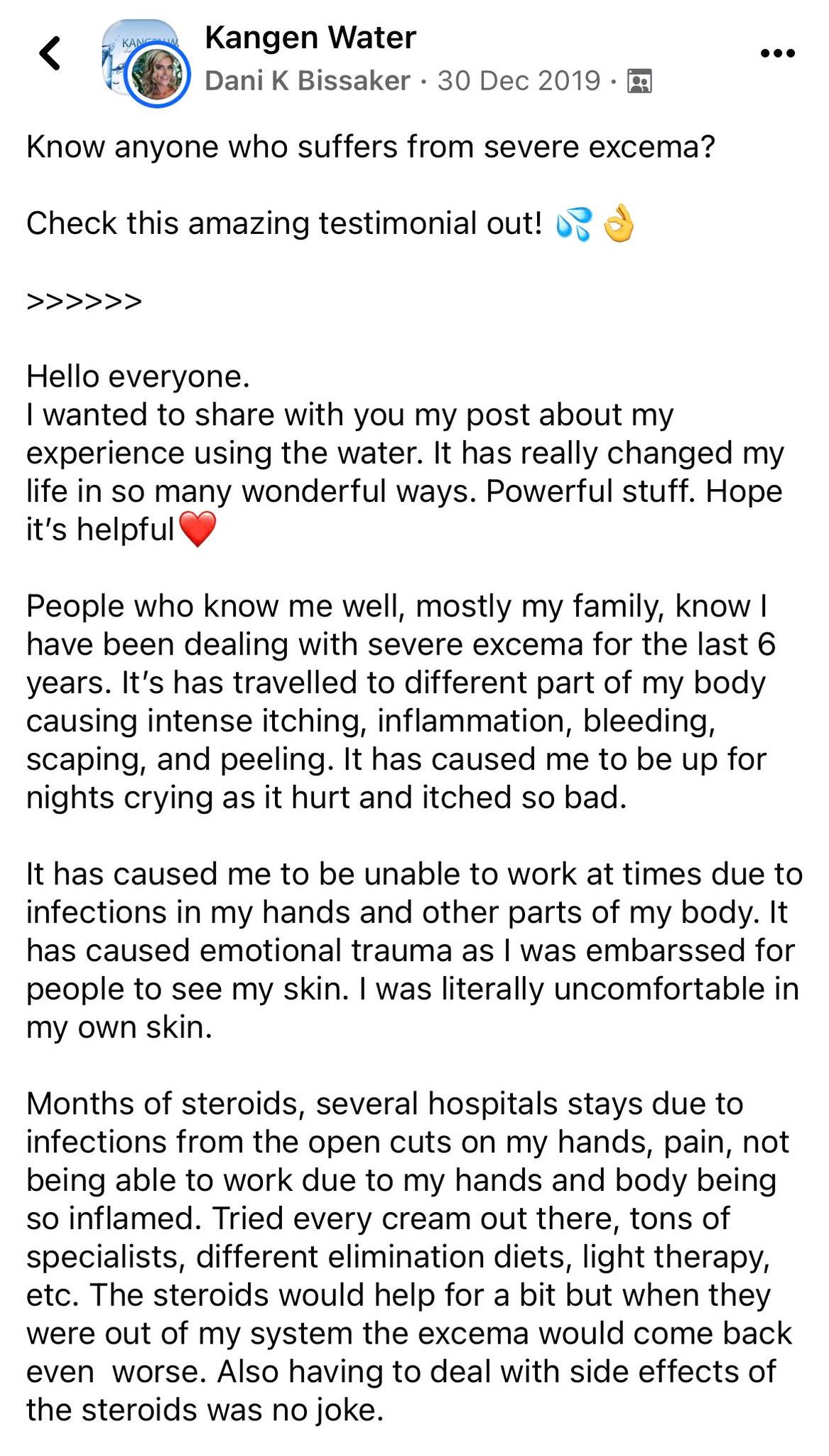Eczema Eczema